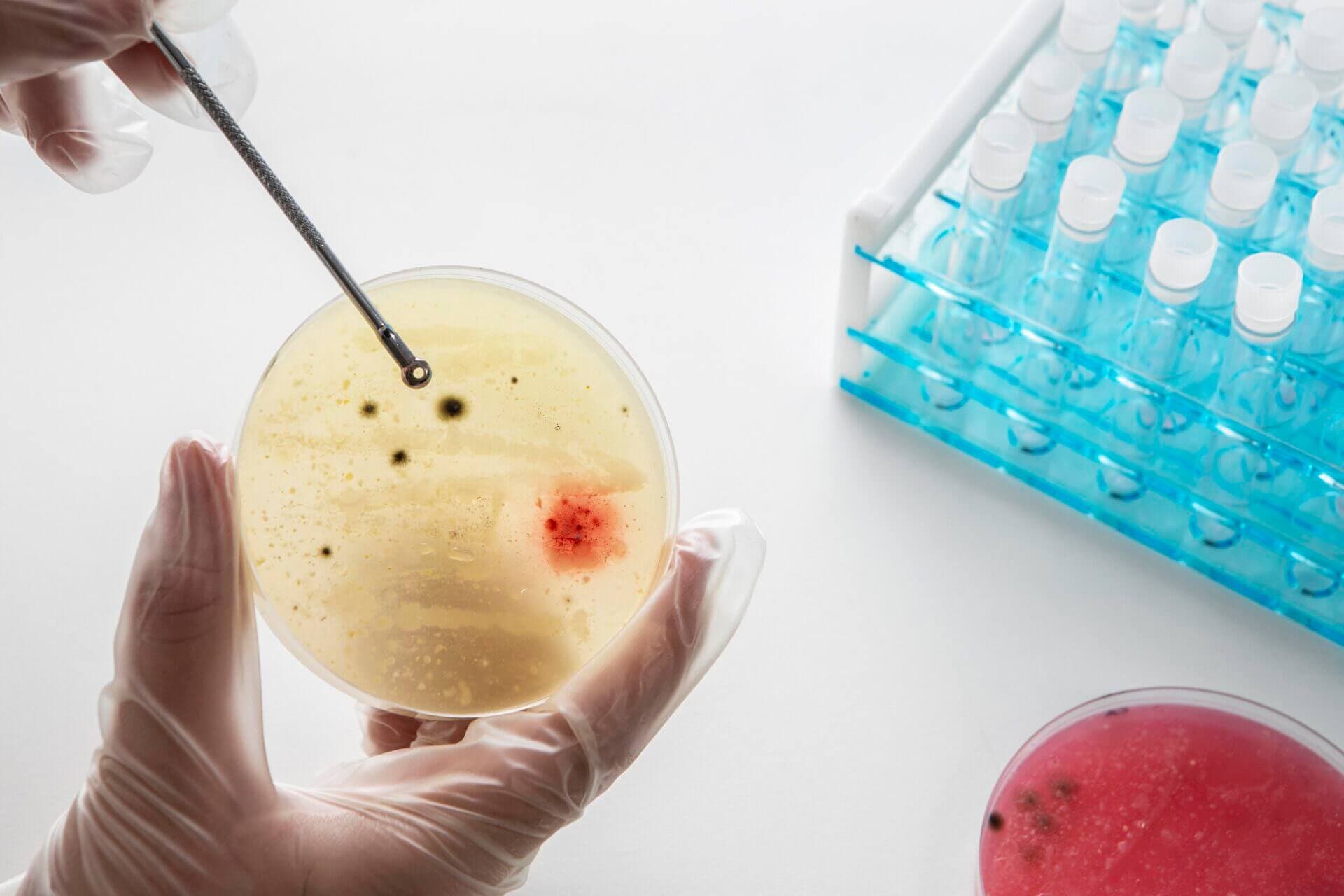 What is a cancer screening test?